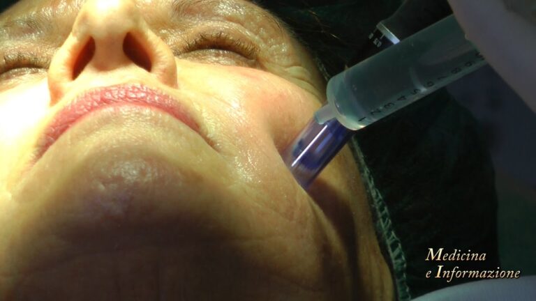 Plasma Lifting: Prezzo Ottimizzato per un Trattamento Efficace